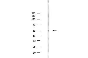 anti-Frizzled Family Receptor 4 (FZD4) (Internal Region) antibody