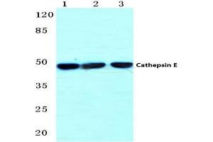 Western blot (WB) analysis of Cathepsin E antibody  at 1/500 dilution. (Cathepsin E Antikörper)