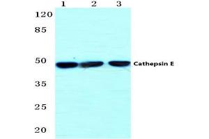 Western blot (WB) analysis of Cathepsin E antibody  at 1/500 dilution.