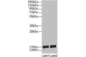 Western blot All lanes: SRP19 antibody at 2 μg/mL Lane 1: Jurkat whole cell lysate Lane 2: Hela whole cell lysate Secondary Goat polyclonal to rabbit lgG at 1/15000 dilution Predicted band size: 17, 13, 9 kDa Observed band size: 17 kDa (SRP19 Antikörper  (AA 2-144))