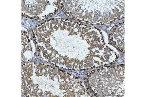 IHC analysis of CAD using anti-CAD antibody (ABIN7600044).