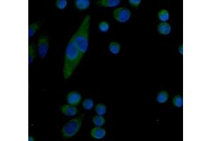 IF analysis of Serum Amyloid P/APCS using anti-Serum Amyloid P/APCS antibody (ABIN5693182).