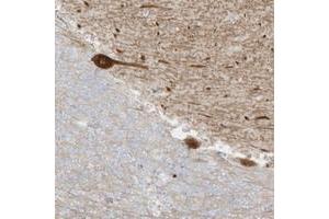 Immunohistochemical staining of human cerebellum with C11orf87 polyclonal antibody  shows strong cytoplasmic positivity in Purkinje cells. (C11ORF87 Antikörper)