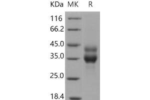 Western Blotting (WB) image for Cathepsin B (CTSB) (Active) protein (His tag) (ABIN7194669) (Cathepsin B Protein (CTSB) (His tag))