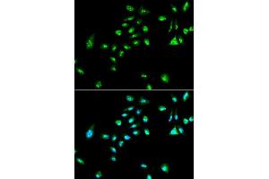 Immunofluorescence analysis of A549 cell using RAF1 antibody.