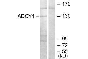 Western blot analysis of extracts from COLO205 cells, using ADCY1 antibody. (ADCY1 Antikörper  (Internal Region))