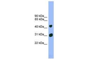 Image no. 1 for anti-LIM Homeobox 5 (LHX5) (AA 251-300) antibody (ABIN6744536) (LHX5 Antikörper  (AA 251-300))