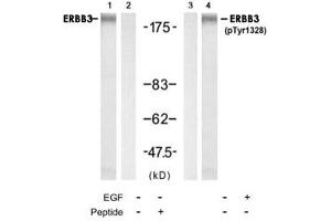Western blot analysis of extracts from HUVEC cell using ERBB3 polyclonal antibody (Cat # PAB12231, Lane 1 and 2) and Phospho-ERBB3 Y1328 polyclonal antibody (Cat # PAB12186, Lane 3 and 4). (ERBB3 Antikörper  (Tyr1328))