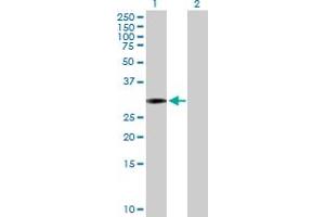 Western Blot analysis of SCML1 expression in transfected 293T cell line by SCML1 MaxPab polyclonal antibody. (SCML1 Antikörper  (AA 1-208))