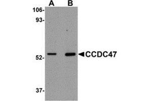 Western blot analysis of CCDC47 in mouse heart tissue lysate with AP30211PU-N CCDC47 antibody at (A) 1 and (B) 2 μg/ml. (CCDC47 Antikörper  (C-Term))