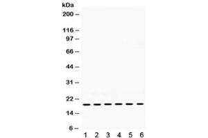 Western blot testing of 1) rat skeletal muscle, 2) rat thymus, 3) mouse brain, 4) mouse thymus, 5) human 22RV1, and 6) human MCF7 lysate with PTP4A2 antibody. (PTP4A2 Antikörper)