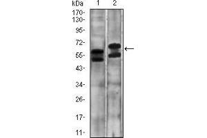 Western blot analysis using CA9 mouse mAb against A431 (1) and SW620 (2) cell lysate. (CA9 Antikörper  (AA 37-186))