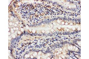 Immunohistochemistry (IHC) image for anti-Valosin Containing Protein (VCP) (AA 749-766), (C-Term) antibody (ABIN3043984)