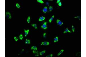 Immunofluorescence staining of SH-SY5Y cells with ABIN7167956 at 1:33, counter-stained with DAPI. (ARHGAP32 Antikörper  (AA 130-205))