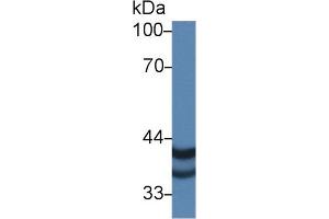 Western blot analysis of Human A375 cell lysate, using Human PSG2 Antibody (1 µg/ml) and HRP-conjugated Goat Anti-Rabbit antibody ( (PSG2 Antikörper  (AA 35-335))
