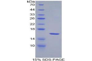 SDS-PAGE analysis of Mouse IL18R1 Protein. (IL18R1 Protein)