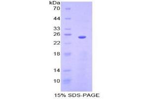 SDS-PAGE analysis of Mouse Sprouty Homolog 3 Protein.