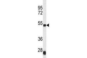 Western blot analysis of Serpinh1 antibody and rat heart tissue lysate; Ab used at 1:100.