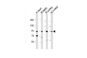 All lanes : Anti-PDE1C Antibody (Center) at 1:1000-2000 dilution Lane 1: human heart lysate Lane 2: mouse testis lysate Lane 3: rat kidney lysate Lane 4: NCI- whole cell lysate Lysates/proteins at 20 μg per lane. (PDE1C Antikörper  (AA 375-409))