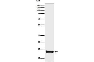 Western blot analysis of Cystatin B expression in U87-MG cell lysate.