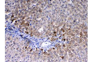 Immunohistochemistry (IHC) image for anti-Endoglin (ENG) (AA 27-226) antibody (ABIN5518982)