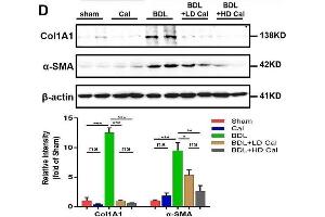 Calcipotriol alleviates BDL-induced liver injury and fibrosis. (COL1A1 Antikörper  (AA 100-200))