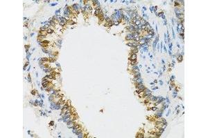 Immunohistochemistry of paraffin-embedded Rat lung using PI3 Polyclonal Antibody at dilution of 1:100 (40x lens). (PI3 Antikörper)