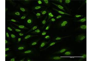 Immunofluorescence (IF) image for anti-Heterogeneous Nuclear Ribonucleoprotein U-Like 1 (HNRNPUL1) (AA 1-804) antibody (ABIN524508)