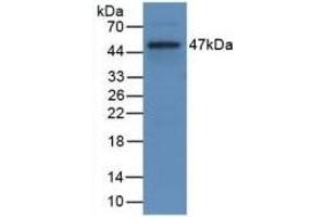 Detection of Recombinant CD40L, Rat using Monoclonal Antibody to Cluster Of Differentiation 40 Ligand (CD40L)