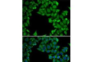 Immunofluorescence analysis of MCF7 cells using RTKN Polyclonal Antibody (Rhotekin Antikörper)