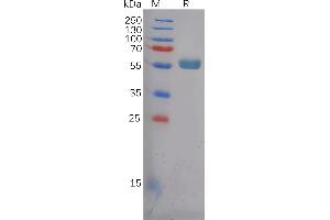 SDS-PAGE (SDS) image for Frizzled Family Receptor 4 (FZD4) (AA 37-180) protein (Fc Tag) (ABIN7092774)