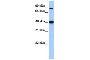 ACAT1 antibody used at 1 ug/ml to detect target protein. (ACAT1 Antikörper)