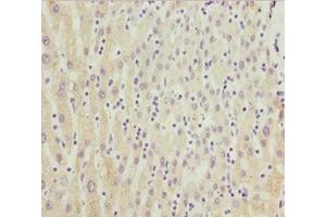 Immunohistochemistry (IHC) image for anti-Cytochrome P450, Family 3, Subfamily A, Polypeptide 4 (CYP3A4) (AA 244-503) antibody (ABIN7149264)