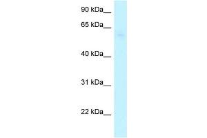 WB Suggested Anti-ARHGAP28 Antibody Titration: 1. (ARHGAP28 Antikörper  (C-Term))