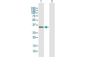 Western Blot analysis of STX11 expression in transfected 293T cell line by STX11 MaxPab polyclonal antibody. (Syntaxin 11 Antikörper  (AA 1-287))