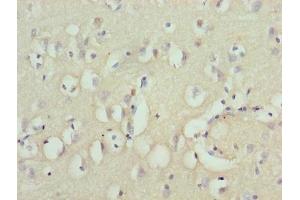 Immunohistochemistry of paraffin-embedded human brain tissue using ABIN7176132 at dilution of 1:100 (ZNF177 Antikörper  (AA 1-321))