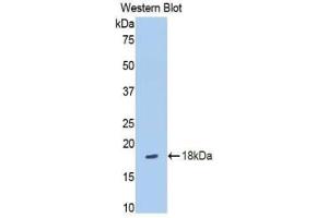 Western blot analysis of the recombinant protein. (SLIT3 Antikörper  (AA 35-119))