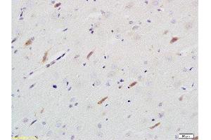 Formalin-fixed and paraffin embedded rat brain tissue labeled with Rabbit Anti-Neuroligin 1 Polyclonal Antibody  at 1:200 followed by conjugation to the secondary antibody and DAB staining. (Neuroligin 1 Antikörper  (AA 701-800))