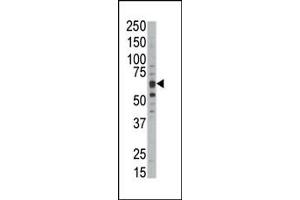 Western blot analysis of anti-DYRKB Pab (ABIN391774 and ABIN2841635) in mouse kidney tissue lysate. (DYRK1B Antikörper  (C-Term))