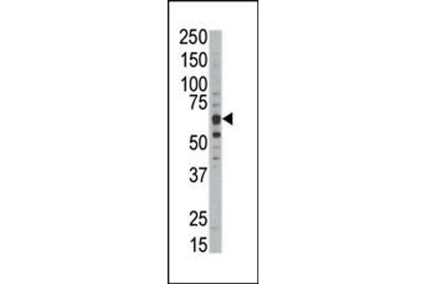 DYRK1B Antikörper  (C-Term)