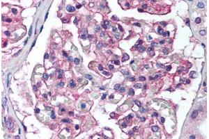 Human Kidney (formalin-fixed, paraffin-embedded) stained with PTK2B antibody ABIN239840 at 1:50 followed by biotinylated goat anti-rabbit IgG secondary antibody ABIN481713, alkaline phosphatase-streptavidin and chromogen. (PTK2B Antikörper  (N-Term))