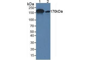 Figure. (alpha 2 Macroglobulin Antikörper  (AA 616-856))