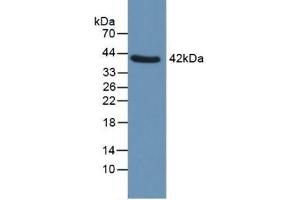 Western blot analysis of Human Uterus. (QPCT Antikörper  (AA 29-361))
