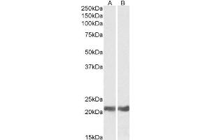 ABIN238599 (0. (CRYAB Antikörper  (Internal Region))