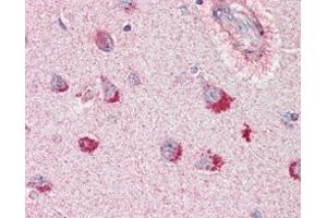 Immunohistochemical analysis of paraffin-embedded human brain, cortex tissues using SORL1 mouse mAb. (SORL1 Antikörper)