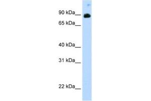 Western Blotting (WB) image for anti-Signal Transducer and Activator of Transcription 6, Interleukin-4 Induced (STAT6) antibody (ABIN2461683) (STAT6 Antikörper)