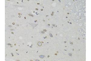 Immunohistochemistry of paraffin-embedded rat spinal cord using LMNB1 antibody (ABIN5970980) at dilution of 1/100 (40x lens). (Lamin B1 Antikörper)