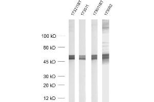 dilution: 1 : 1000, sample: rat brain homogenate (GFAP Antikörper)
