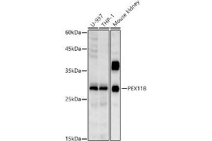 Western blot analysis of extracts of various cell lines, using PEX11B antibody (ABIN7269244) at 1:1000 dilution. (PEX11B Antikörper)