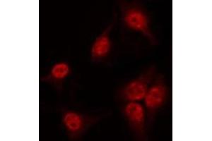 ABIN6267539 staining 293 by IF/ICC. (SOX9 Antikörper  (pSer181))